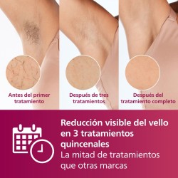 Depiladora Philips Lumea IPL Serie 7000 Advanced BRI920/00