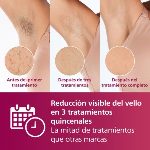 Depiladora Philips Lumea IPL Serie 7000 Advanced BRI920/00